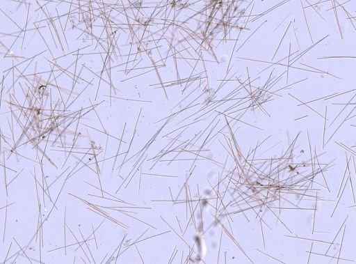 Suberites sp.