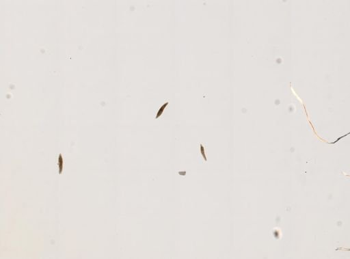 Paramecium