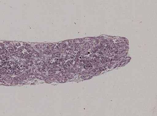 Modiolus