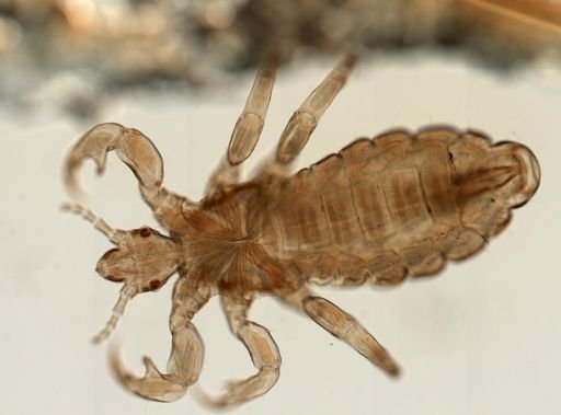 Pediculus humanus
