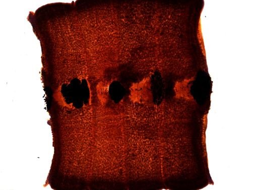 Diphyllobothrium erinacei