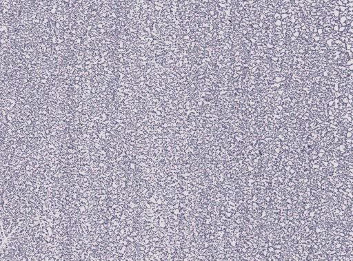 Plasmodium cathemerium