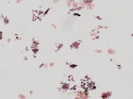 Amoeba proteus