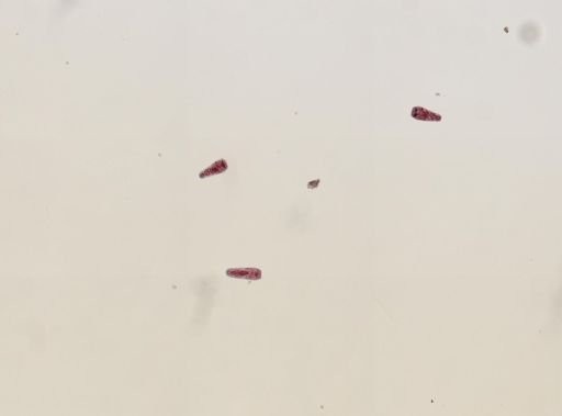 Fasciola hepatica