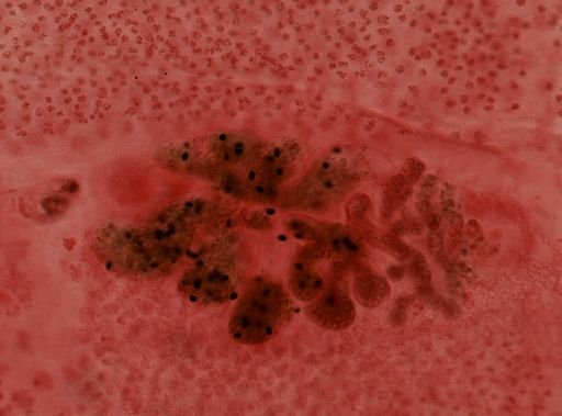 Diphyllobothrium latum