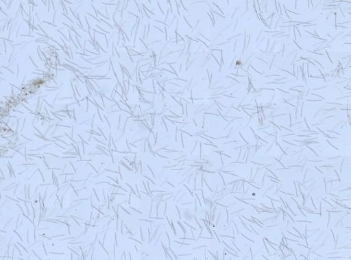 Haliclona?