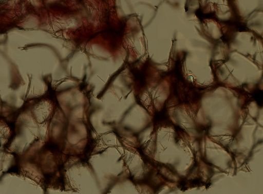 Isodictya deichmannae