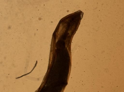 Enterobius vermicularis