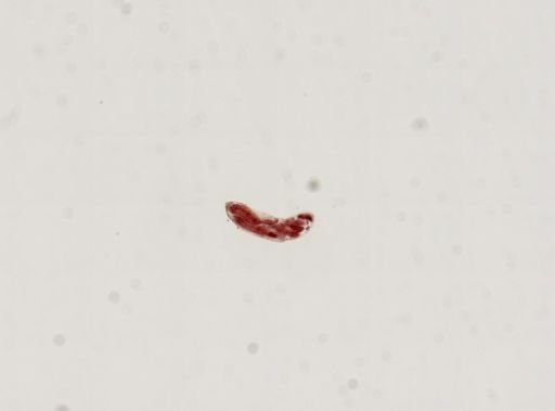 Trematoda