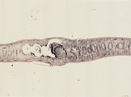 Turbellaria