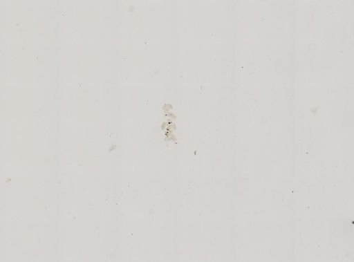 Paramecium polycaryum