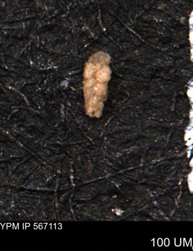Verneuilina canadensis