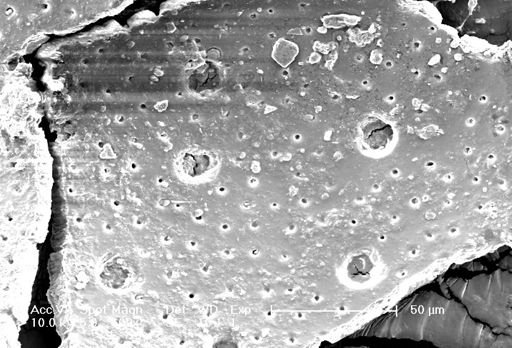 Orbulina universa