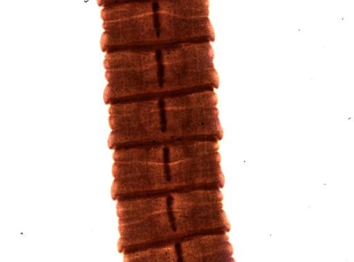 Diphyllobothrium erinacei