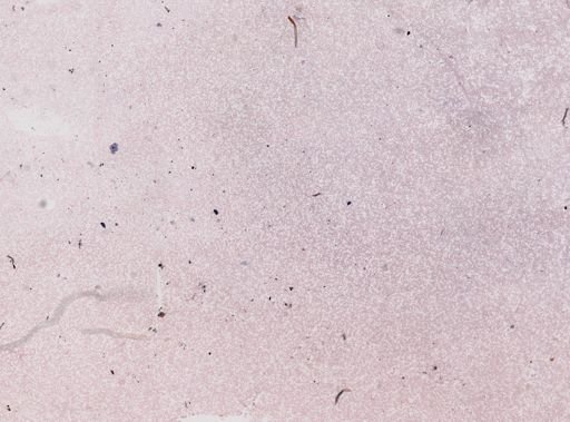 Trypanosoma equinum
