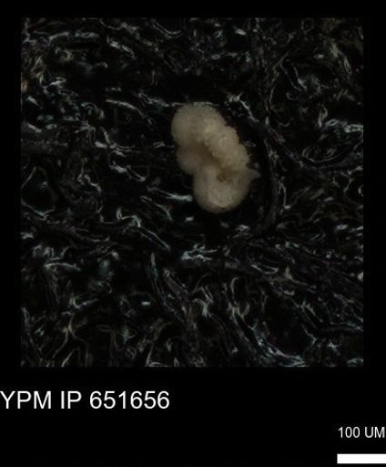 undet. Rugoglobigerinidae