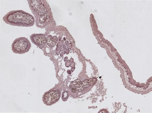 Cratena pilata