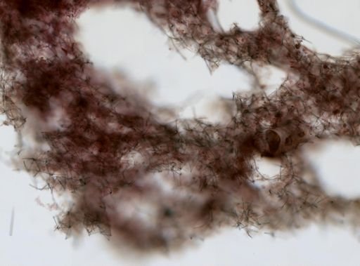 Haliclona?