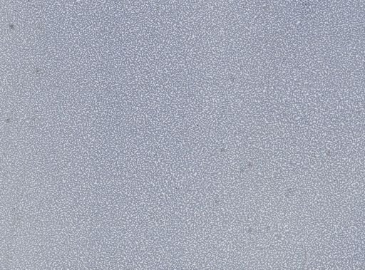 Plasmodium vivax