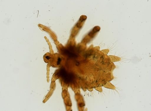 Pthirus pubis