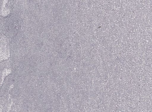 Haemoproteus columbae