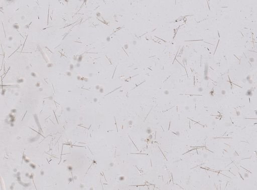 Echinostylinos sp.
