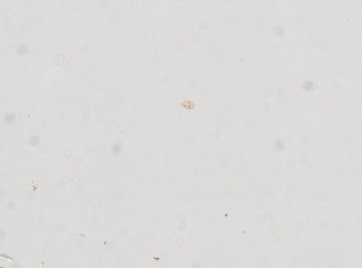 Paramecium polycaryum