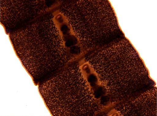 Diphyllobothrium erinacei