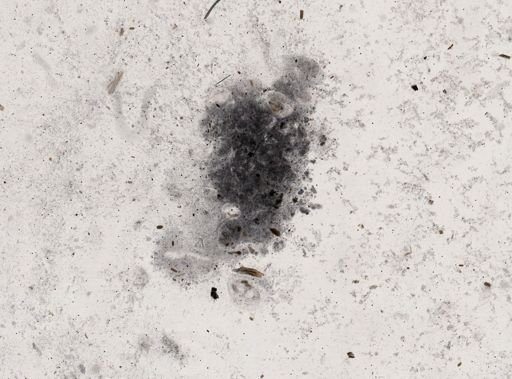 Giardia lamblia