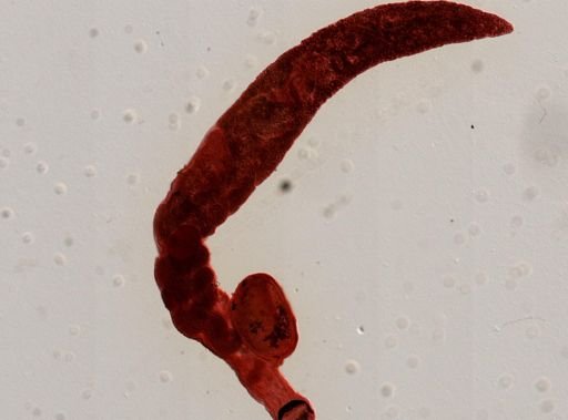Gorgoderina