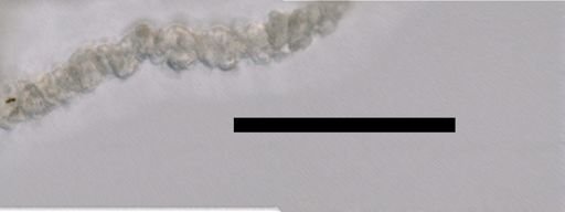 Apolemia rubriversa