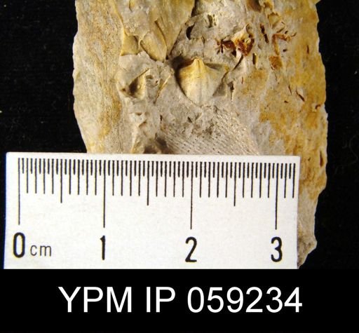 Metaplasia pyxidata
