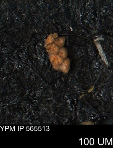 Verneuilina canadensis