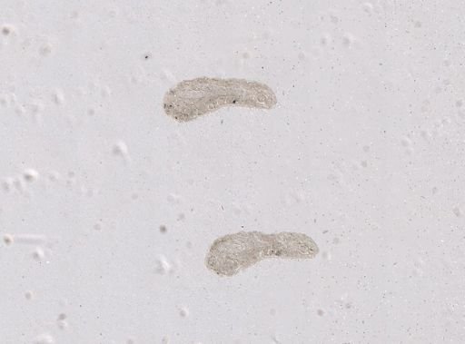 Paravortex gemellipara