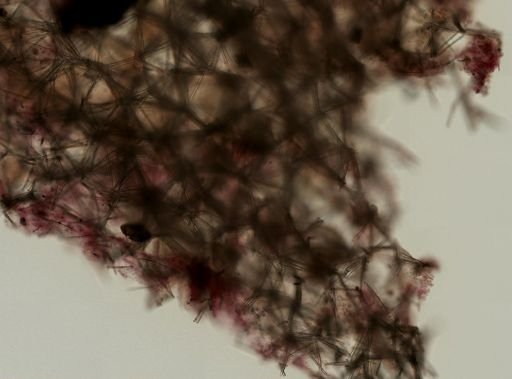 Myxilla perspinosa