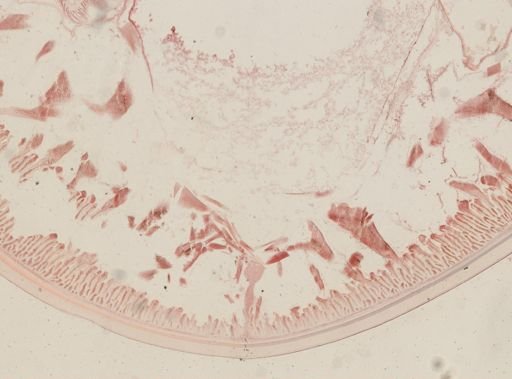 Ascaris megalocephala