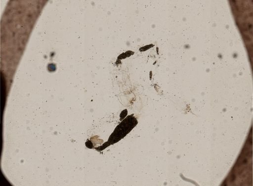 Tanytarsus