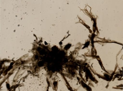 Victorella pavida