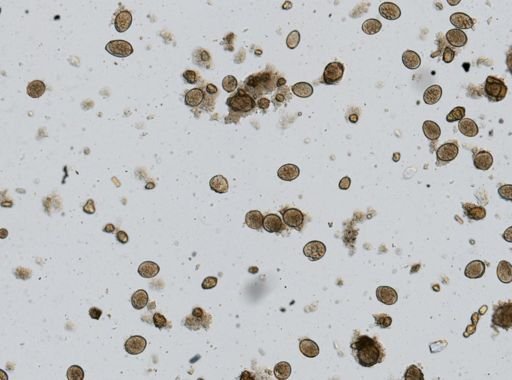 Diphyllobothrium latum