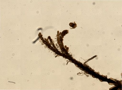 Urnatella gracilis