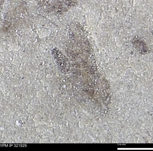 undet. Insecta