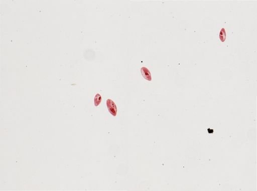 Paramecium calkinsi