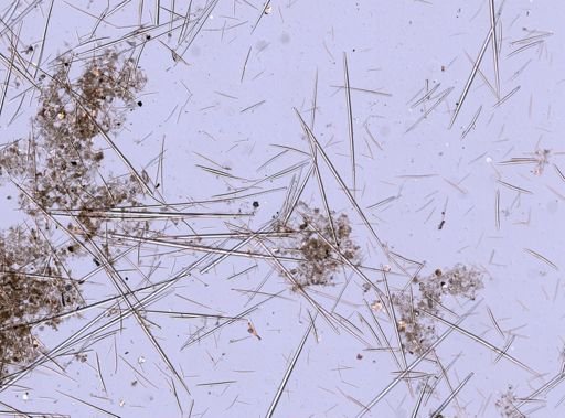 Polymastia sp.
