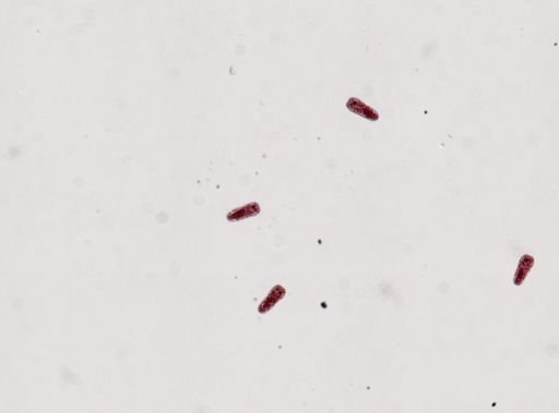 Fasciola hepatica
