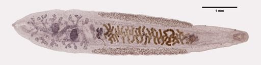 Clonorchis sinensis