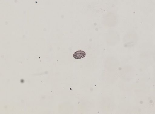 Plagiostomum whitmani