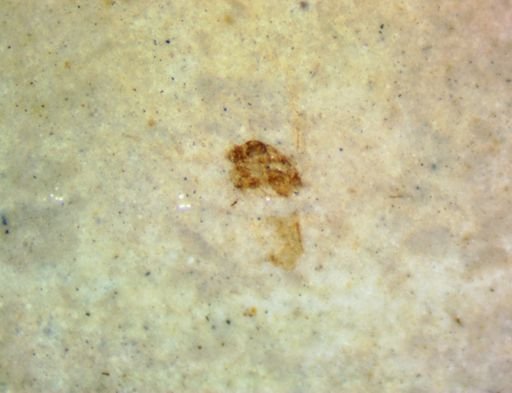 undet. Hexapoda