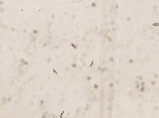 Paramecium putrinum
