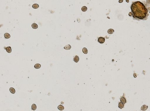 Diphyllobothrium latum