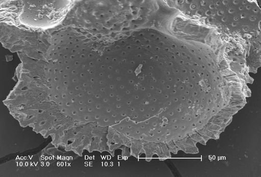 Globigerinoides sacculifer